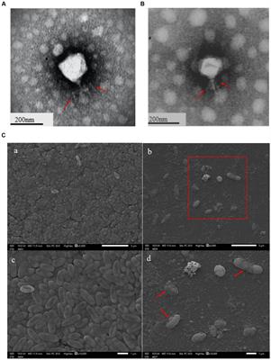 Characterization of Pseudomonas aeruginosa bacteriophages and control hemorrhagic pneumonia on a mice model